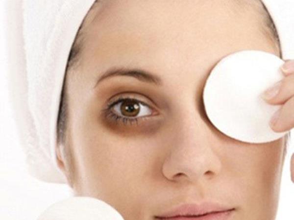 Do you want to get rid of dark circles under your eyes? No problem!