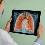 How can we easily detect early signs of lung cancer