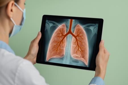 How can we easily detect early signs of lung cancer