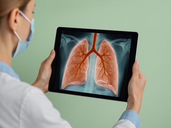 How can we easily detect early signs of lung cancer