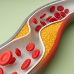 How to lower cholesterol naturally