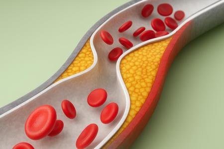 How to lower cholesterol naturally