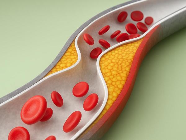 How to lower cholesterol naturally