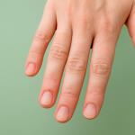 Do you know which are the first symptoms of cancer that first appear on the hands?