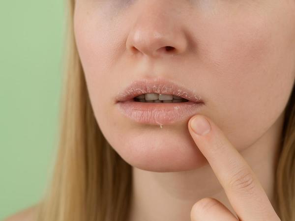 Dry Mouth: Harmless Annoyance, or Your Body's Quiet Way of Waving a Flag?