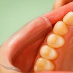 Why Good Hygiene Doesn't Always Protect Your Teeth – and What Diet Can Really Do