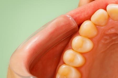 Why Good Hygiene Doesn't Always Protect Your Teeth – and What Diet Can Really Do