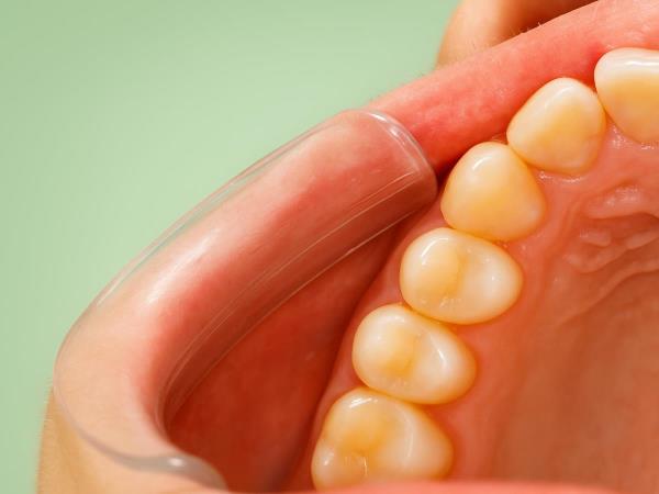 Why Good Hygiene Doesn't Always Protect Your Teeth – and What Diet Can Really Do
